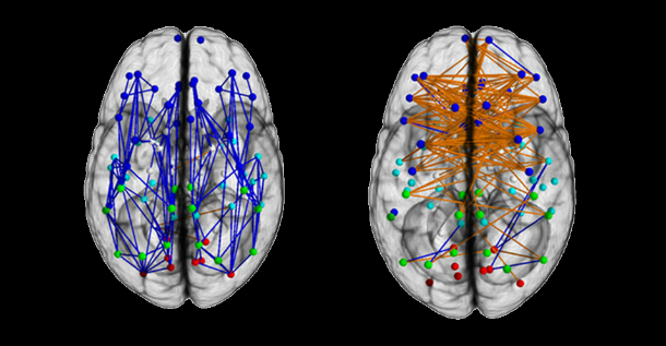 As conexões dominantes no cérebro masculino (esq) e feminino (dir.) segundo novo estudo (Imagem: PNAS)